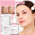 Korean Skincare Complex Peptide Acne Serum with PDRN Collagen - Pore Shrinking Melanin Fading Skin Brightening and Smoothing