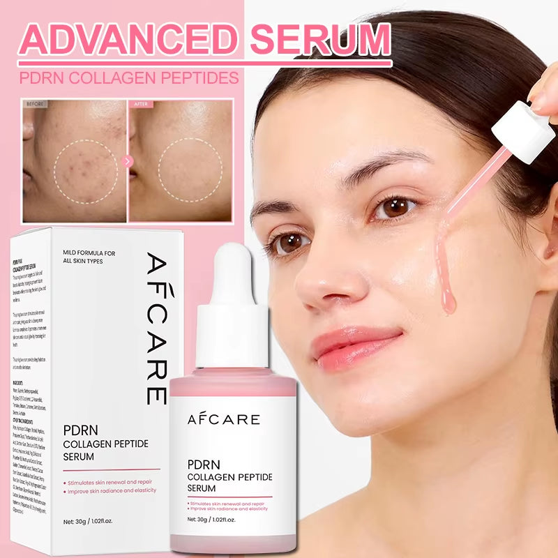Korean Skincare Complex Peptide Acne Serum with PDRN Collagen - Pore Shrinking Melanin Fading Skin Brightening and Smoothing