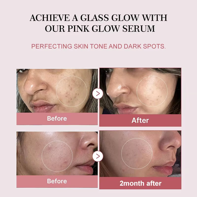 Korean Skincare Complex Peptide Acne Serum with PDRN Collagen - Pore Shrinking Melanin Fading Skin Brightening and Smoothing